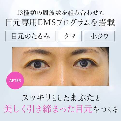 ルクセア　ミューサーサブ画像5