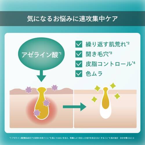 SISI　スマートアクティベーターサブ画像3
